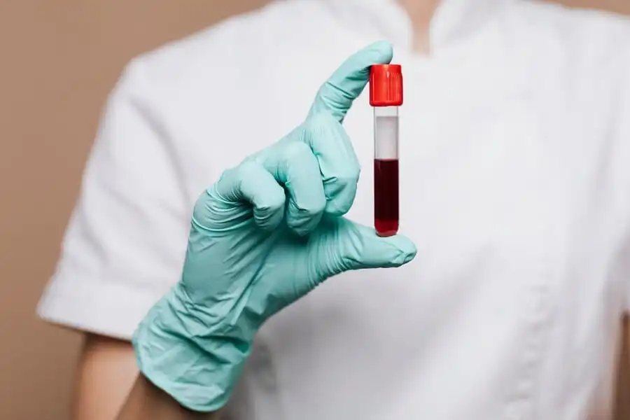 Blood Tests Image